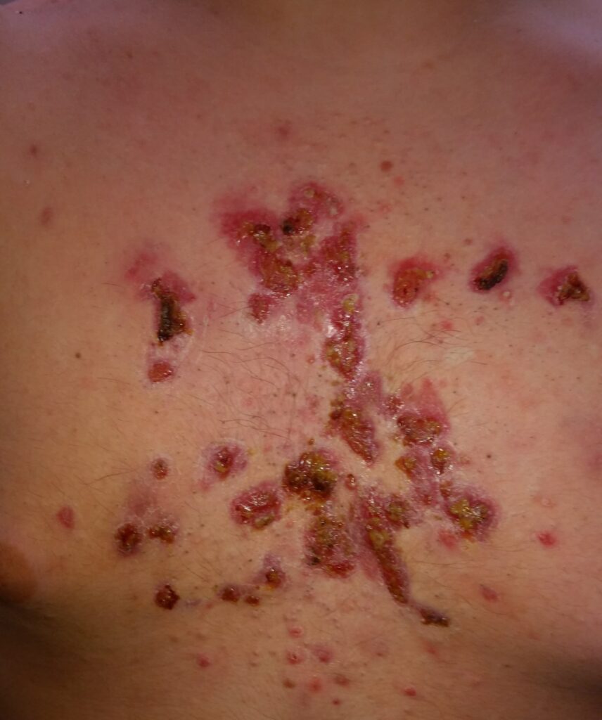 05 Dermatología Argentina 1 2026