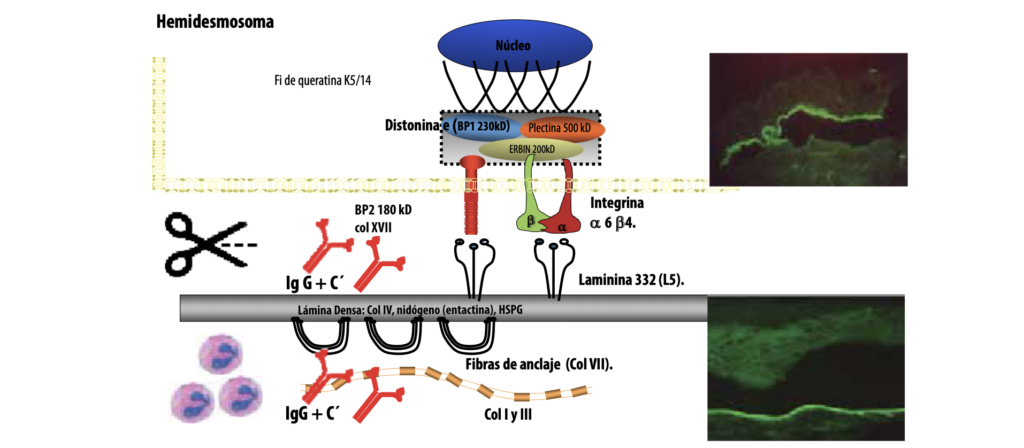 3 Enfermedades ampollares subepidérmicas autoinmunes