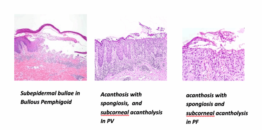 3 Inmunofluorescencia enfermedades ampollares
