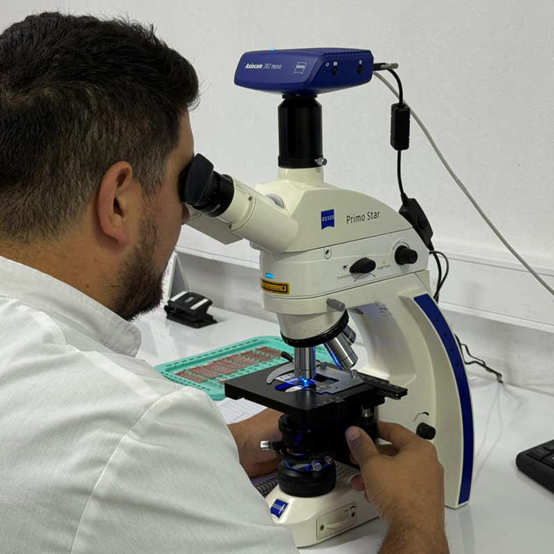 4 Autoanticuerpos enfermedades ampollares