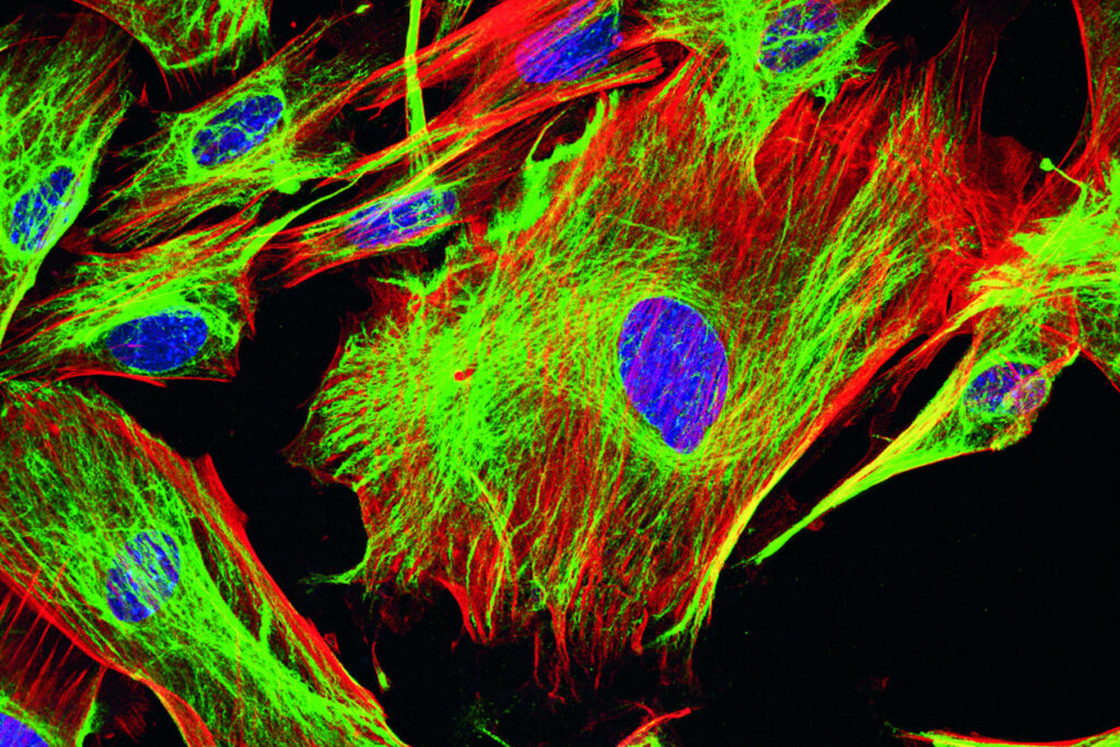 4 Inmunofluorescencia enfermedades ampollares