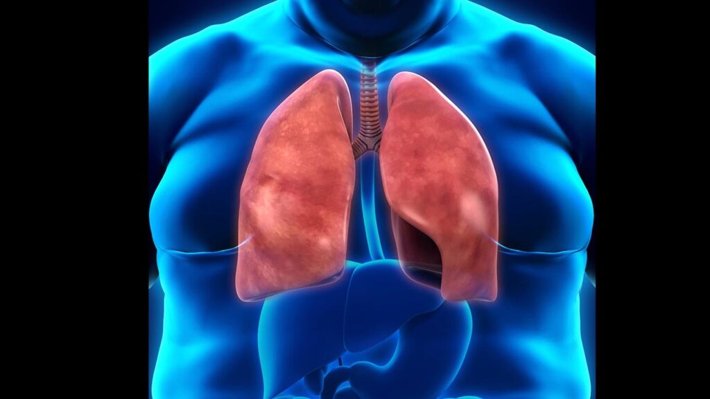 4 Obesidad asma diabetes