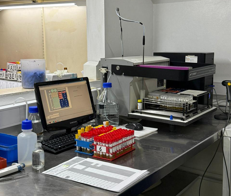 5 Autoanticuerpos enfermedades ampollares