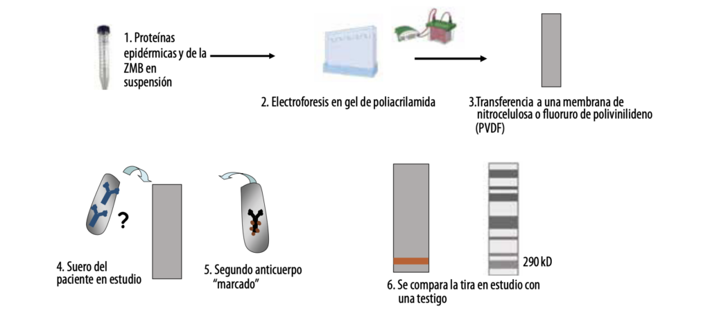 6 Enfermedades ampollares subepidérmicas autoinmunes