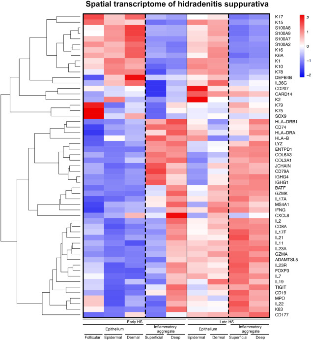 2 Hidradenitis supurativa células T17 B