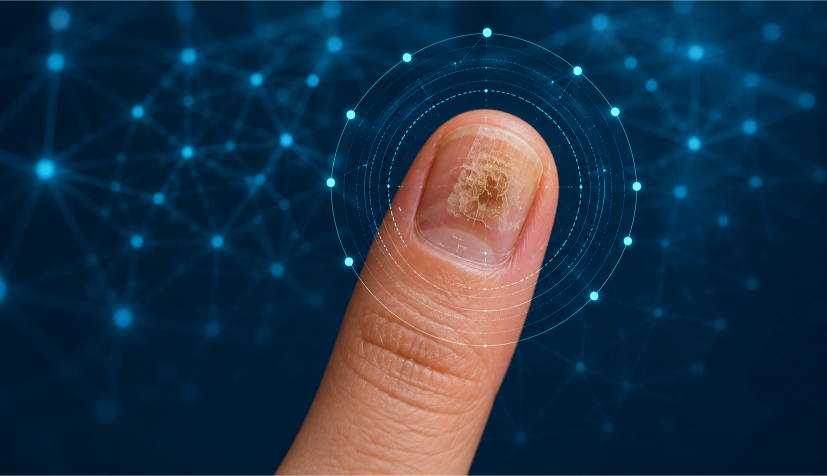 2 Inteligencia artificial enfermedades de las uñas