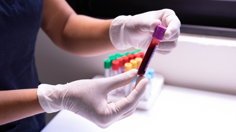 4 Prediabetes y firmas epigenéticas