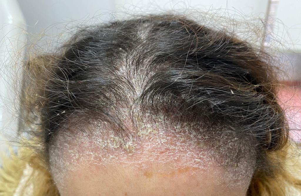 12 Dermatología Argentina 2 2026