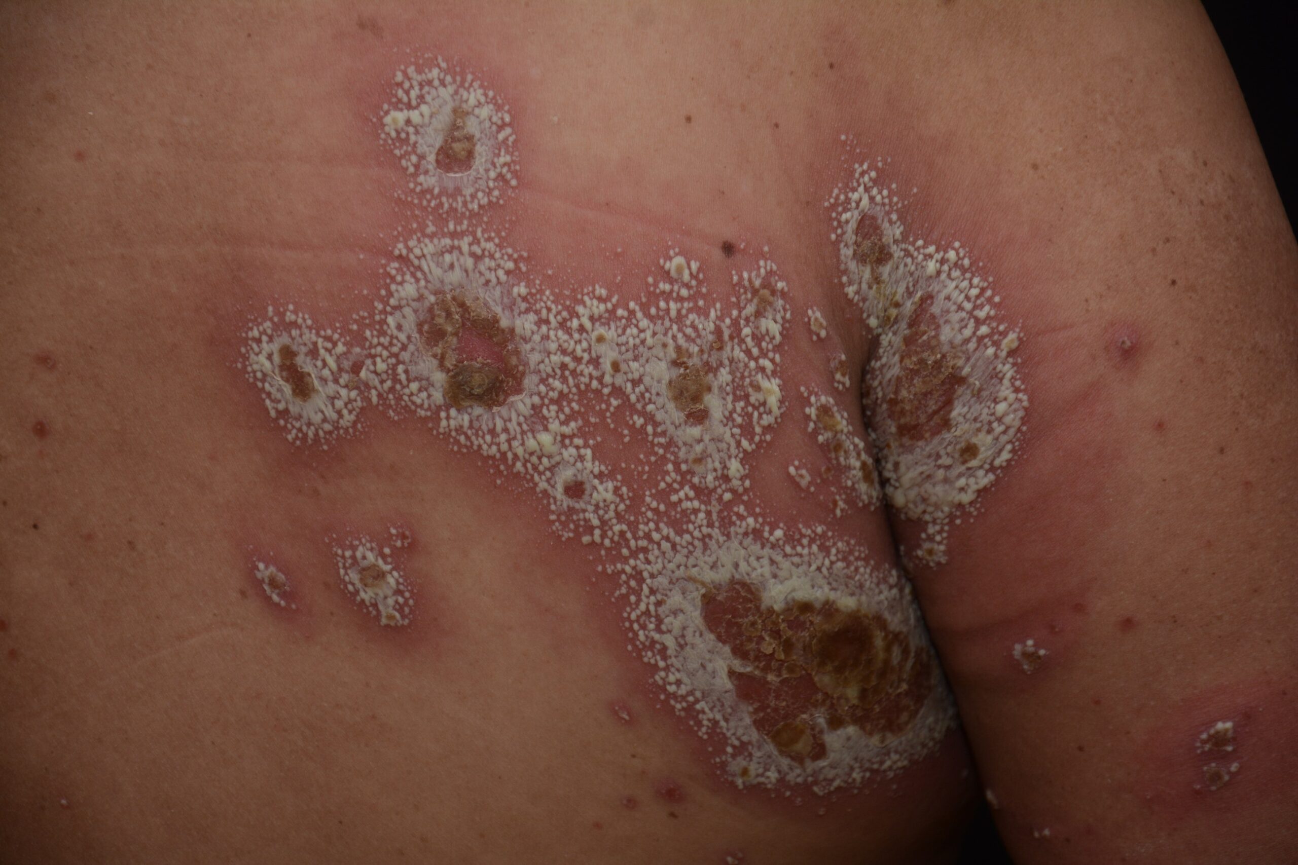 1 Dermatología Argentina 2 2026