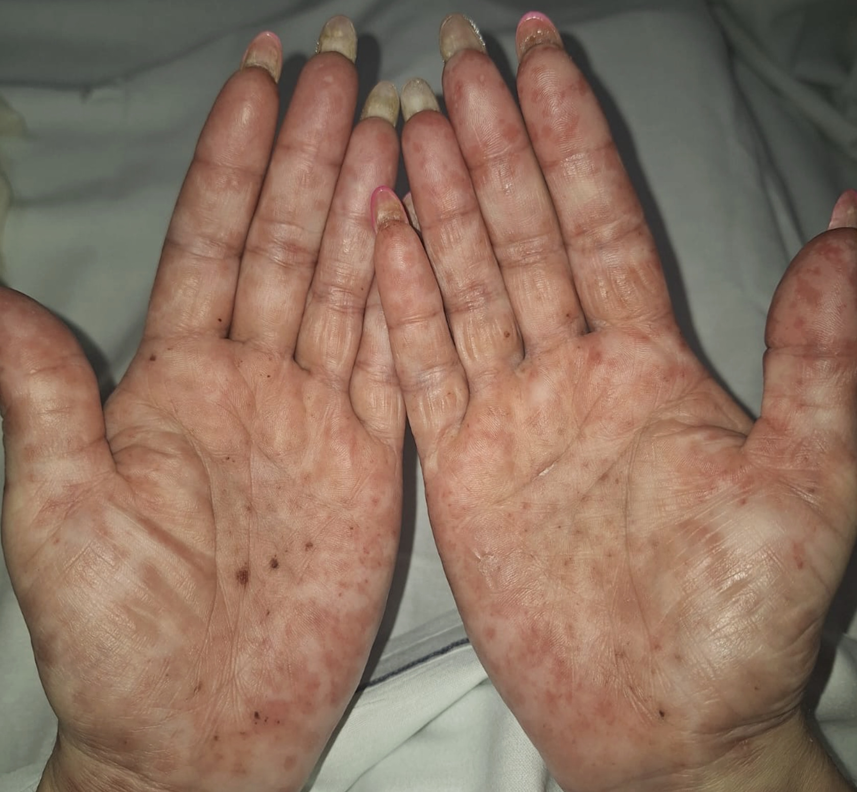 11 12 Dermatología Argentina 2 2026