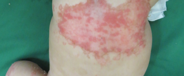 2 Dermatología Argentina 2 2026