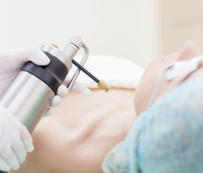 4 Crioterapia mecanismo de acción en dermatología