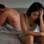 0 Consenso sobre psoriasis y sexualidad