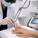 11 Nuevas tecnologías láser para psoriasis ungueal